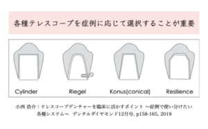 ドイツ式入れ歯を失敗しないポイント