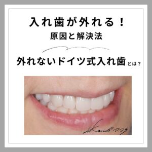 入れ歯が外れる原因と解決法|外れないドイツ式入れ歯とは?