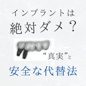 インプラントは絶対ダメ？後悔する前に知るべき“真実”と安全な代替法