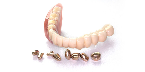 ドイツ式入れ歯（テレスコープ義歯）